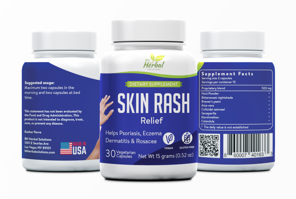 Skin Rash Relief eczema rosacea dermatitis - BH Herbal Solutions